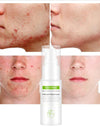 Effective whitening cream, can remove acne essence, treat bleaching, acne spots, control sebum,